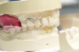 小山市でインプラント治療を受けたい