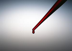 横浜市中区のホワイトニングで綺麗になる